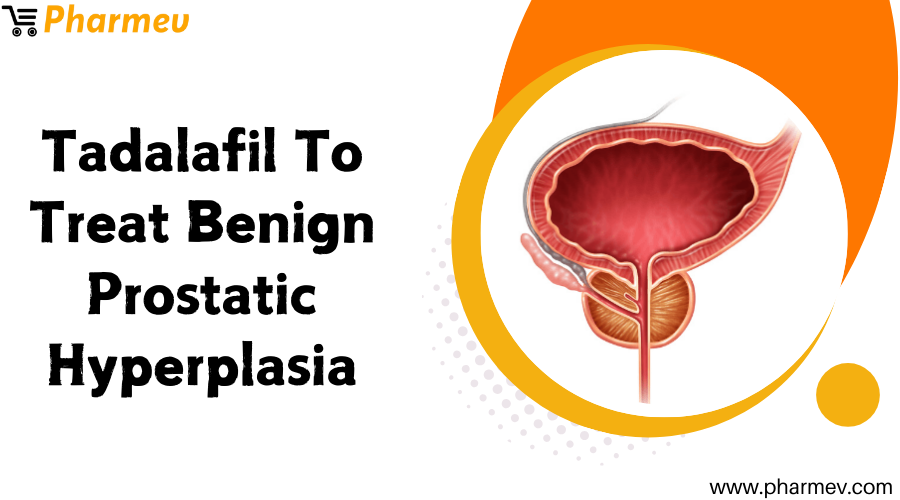 Tadalafil to Treat Benign Prostatic Hyperplasia