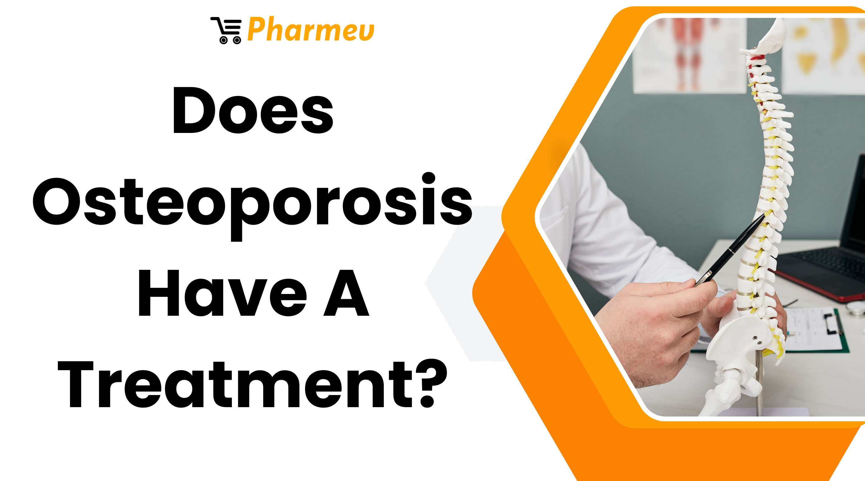 Does Osteoporosis Have A Treatmen