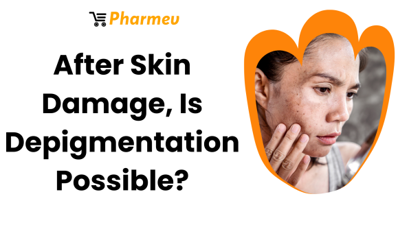 After Skin Damage, Is Depigmentation Possible?